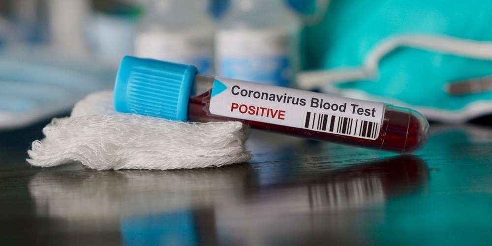 © DR | Coronavirus